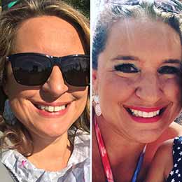 Brandel W. — 6 months | Crowding, protrusion Brandel W. — 6 months | Crowding, protrusion