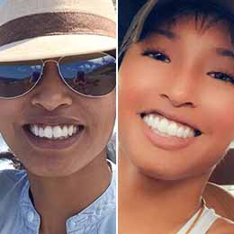 Christina M. — 6 months | Protrusion Christina M. — 6 months | Protrusion