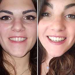Ilaria O. — 4 months | Spacing Ilaria O. — 4 months | Spacing